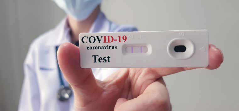  Pelotas registra cerca de 2,8 mil testes para o novo coronavírus